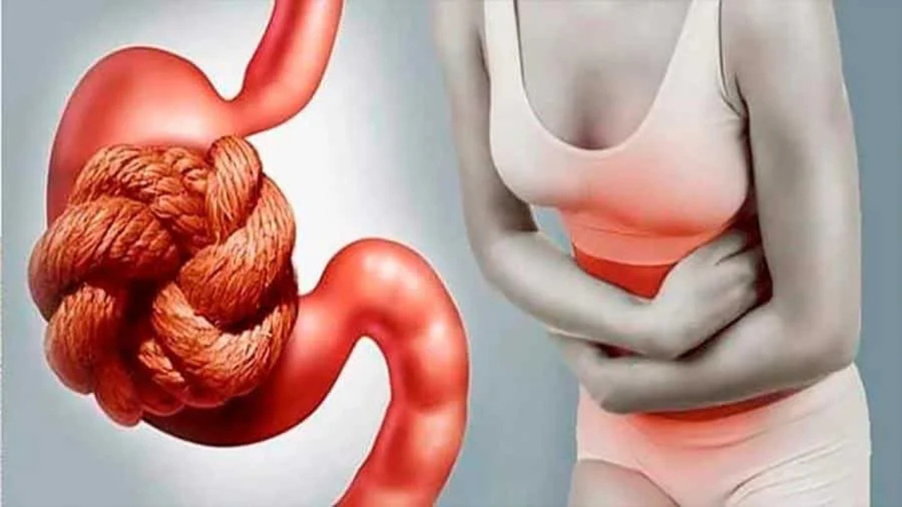 ¿Sufres estreñimiento? Descubre sus causas y los remedios más efectivos para aliviarlo.