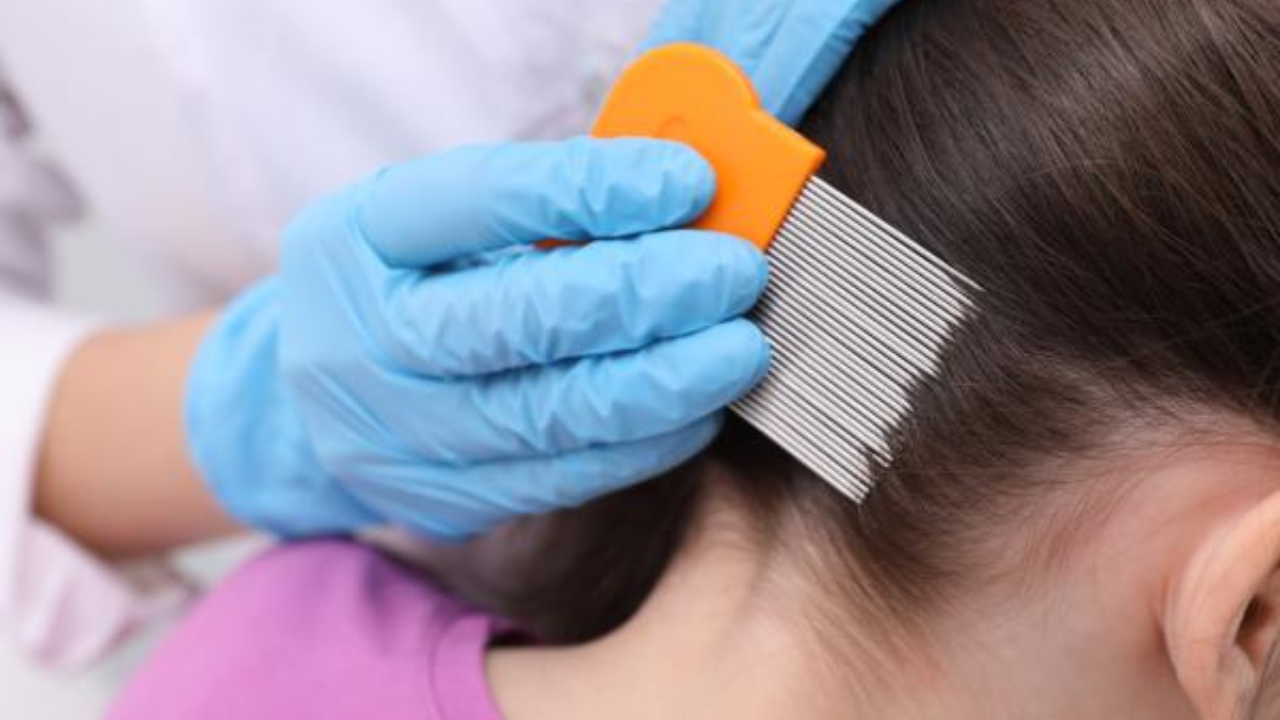 Después de lavar el cabello, utiliza un peine especial para eliminar piojos y liendres.