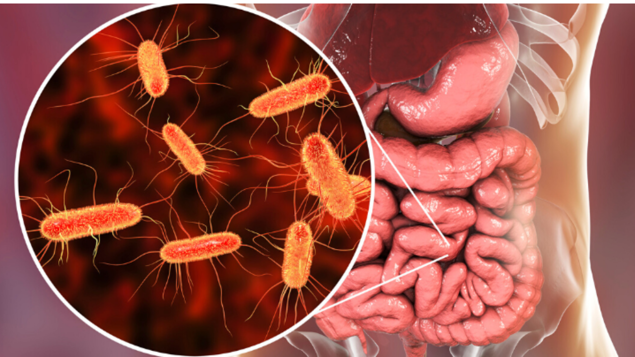 Entre las bacterias más comunes que se encuentran en botellas sucias están: la E. coli, Staphylococcus aureus y la Salmonella.