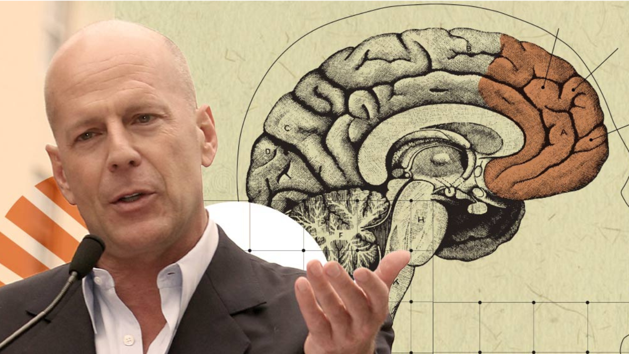 “Bruce Willis: Su lucha contra la demencia frontotemporal: el mensaje que todos deben conocer”