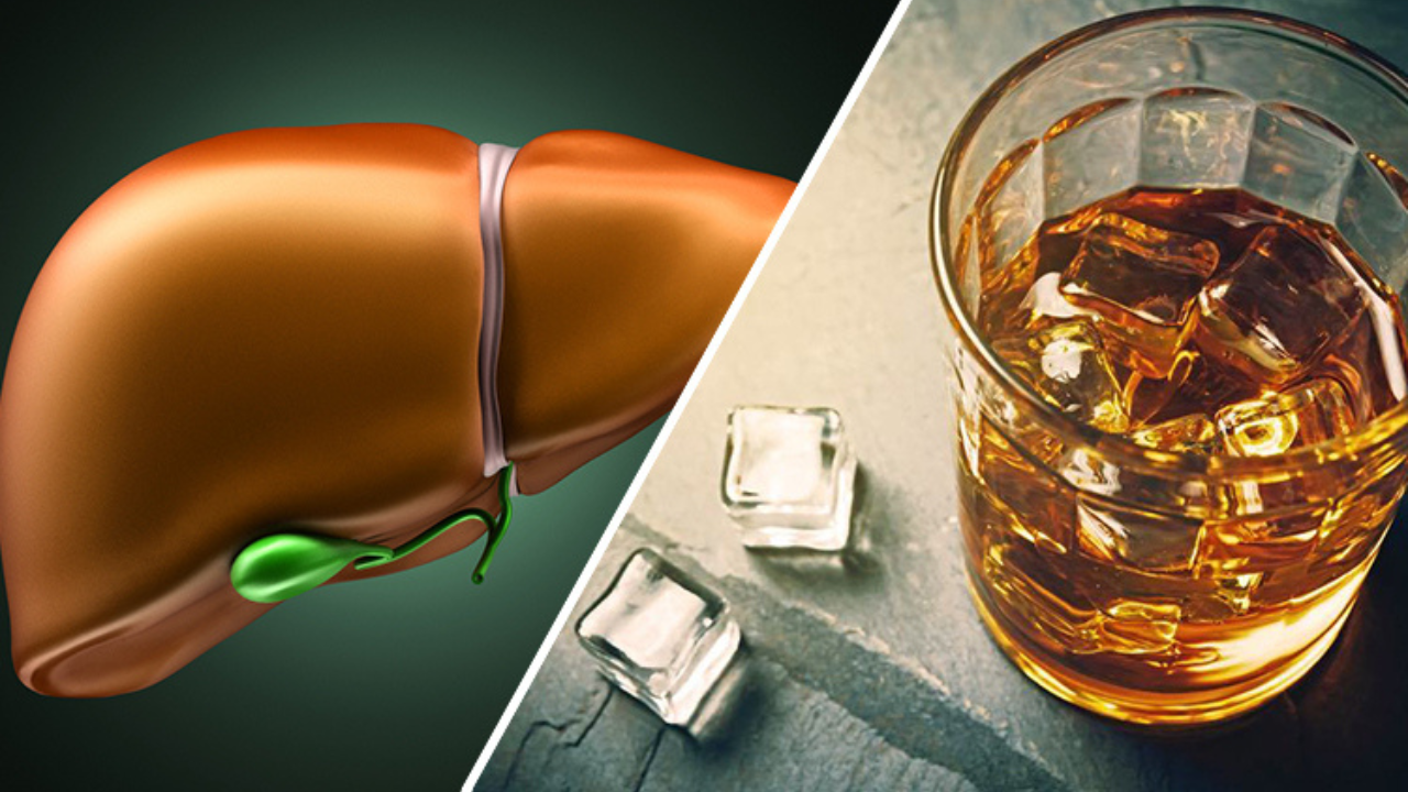 El hígado es el órgano encargado de metabolizar el alcohol. Con un consumo frecuente y elevado, se sobrecarga y comienza a sufrir daños progresivos.