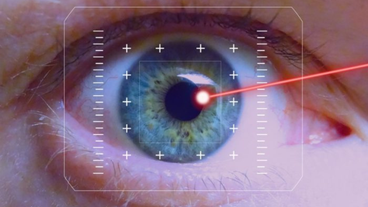 Otra técnica más reciente consiste en el uso de láser para despigmentar el iris, eliminando la melanina y dejando ver un tono más claro, generalmente azul.