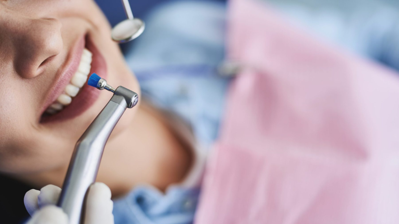 Visita al dentista regularmente: La forma más segura de quitar el sarro es mediante una limpieza dental profesional llamada profilaxis o detartraje.
