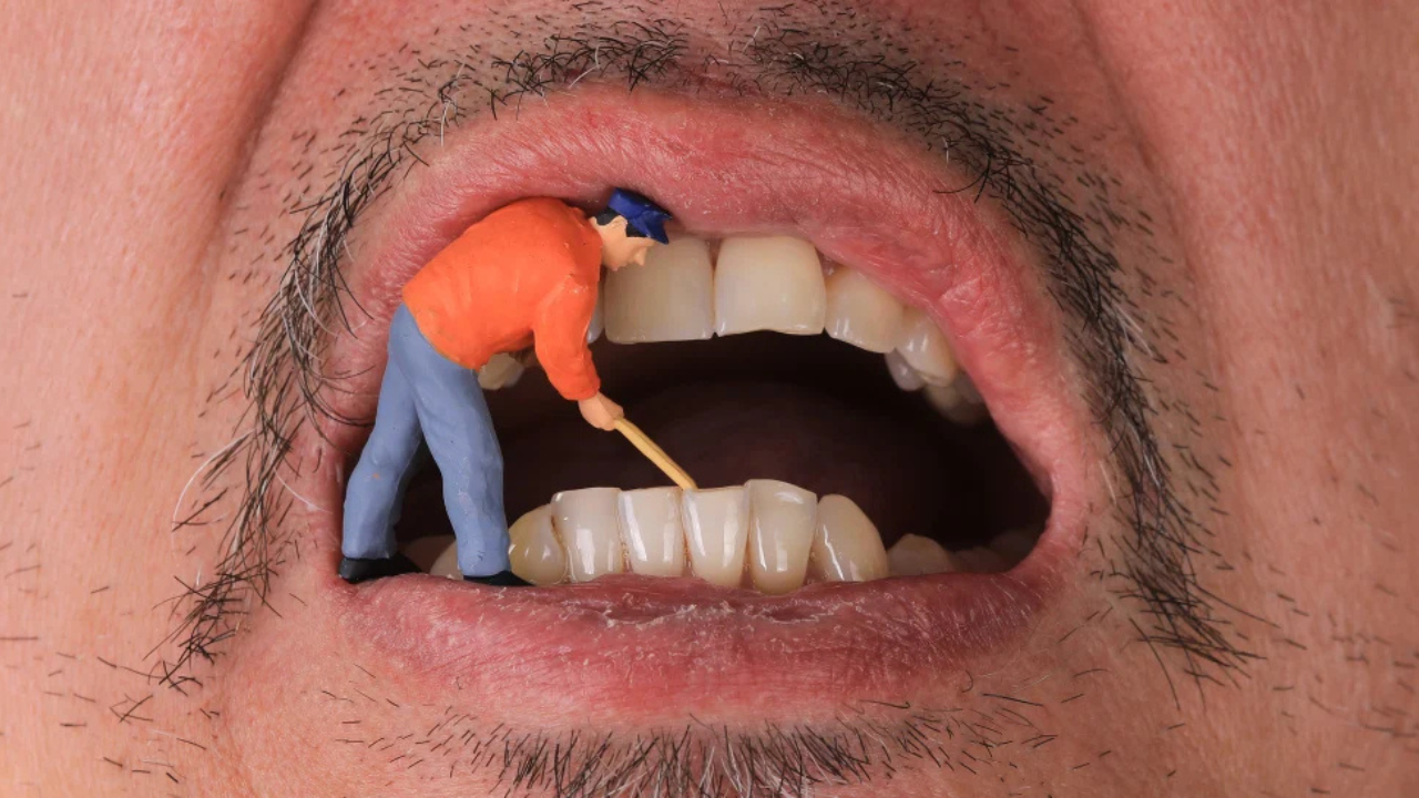 Guía definitiva: ¿Cómo eliminar el sarro de tus dientes y recuperar tu sonrisa?