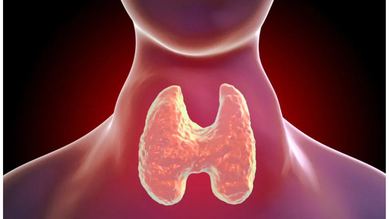 El hipertiroidismo se presenta cuando la tiroides produce demasiadas hormonas, acelerando el metabolismo y provocando un exceso de actividad en el cuerpo.