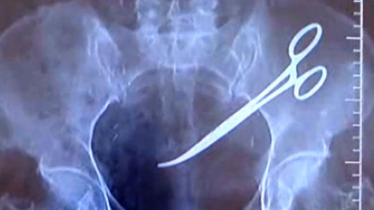 Antes de iniciar cualquier denuncia, es fundamental determinar si realmente se trató de negligencia médica. Esto ocurre cuando un profesional de la salud actúa con imprudencia.