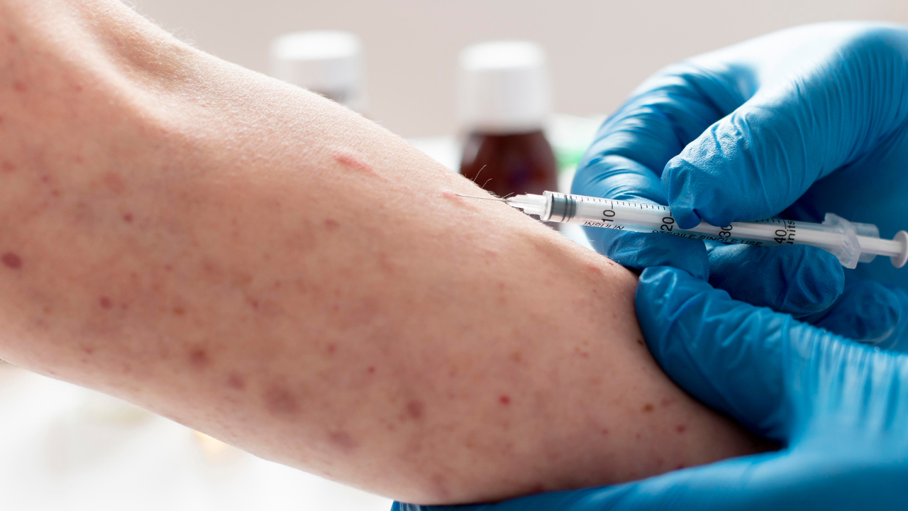 La vacunación contra el sarampión en México se ha convertido en una prioridad sanitaria.